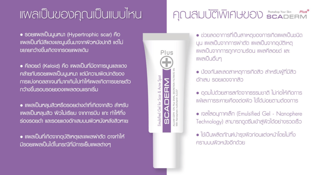 ครีมลดรอยสิว