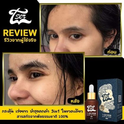 เซรั่มปลูกผม ที่ดีที่สุด