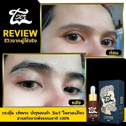 ยาปลูกผม ที่ดีที่สุด
