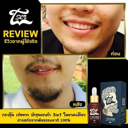 น้ำยาปลูกผม ที่ดีที่สุด
